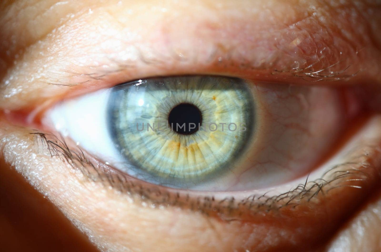 Closeup of human eye and macro photography. Hyperopia, myopia, astigmatism and laser vision correction