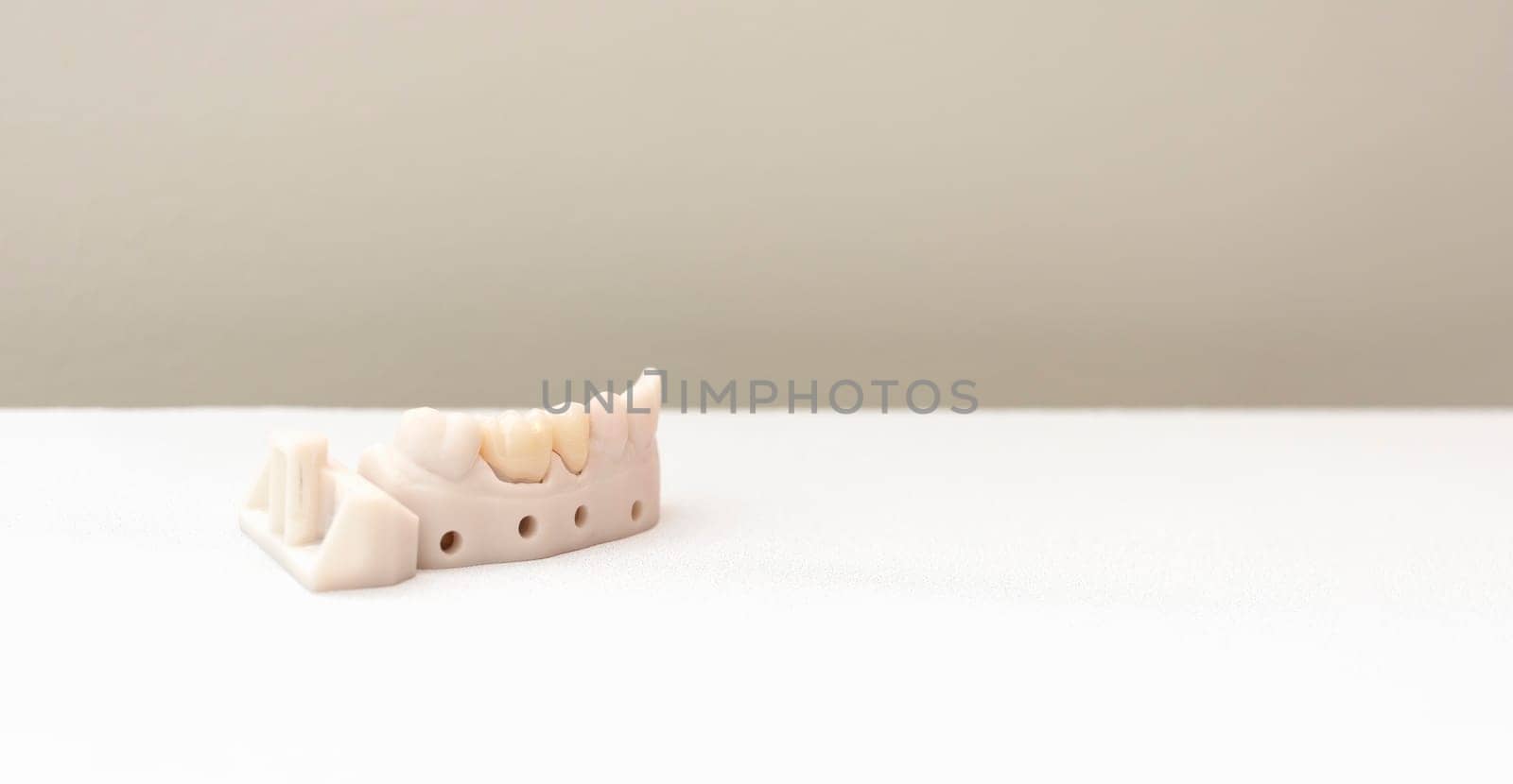 Banner Tooth Crown or Dental Cap in Box, Implant Model Tooth Support On White Table. Copy Space for Text. Crown Delivery. Bridge Placement. Horizontal Plane by netatsi