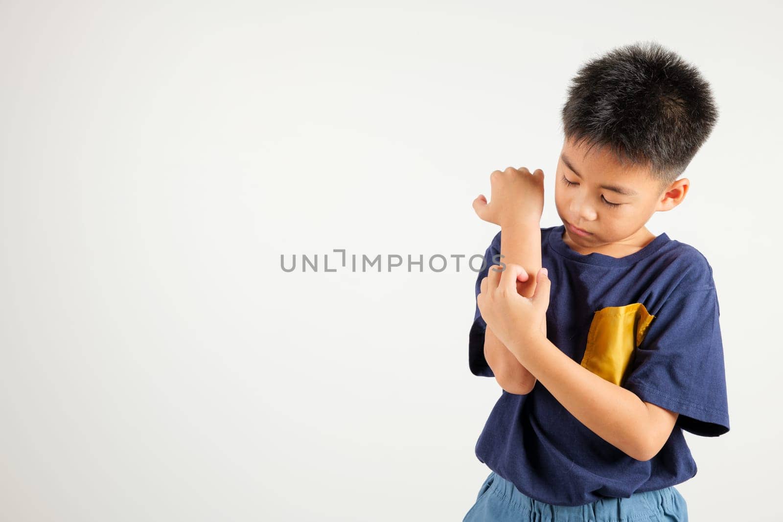 Asian little kid boy scratching itchy arm from a mosquito bite at studio shot isolated on white background, Portrait of Thai primary child dermatitis and scabies, Allergy symptoms, Malaria day concept