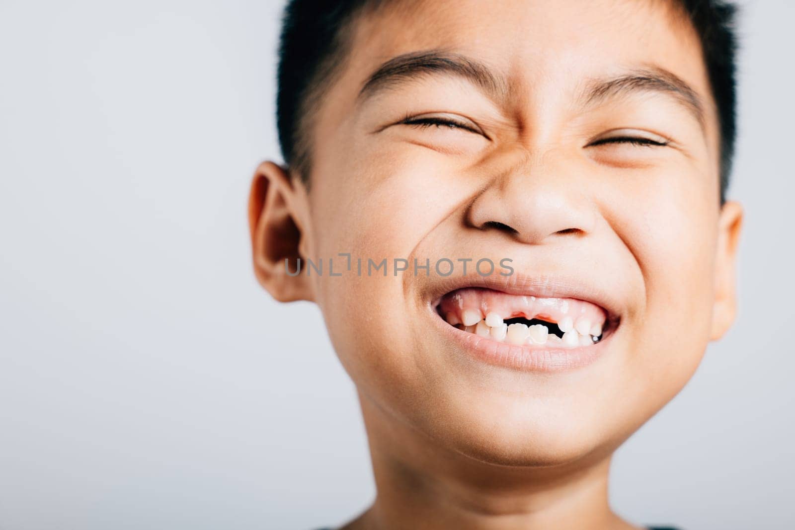 Cheerful kid lost upper tooth gap in smile. Child dental development isolated on white. Tooth fairy moment joyful growth. Children show teeth new gap, dentist problems