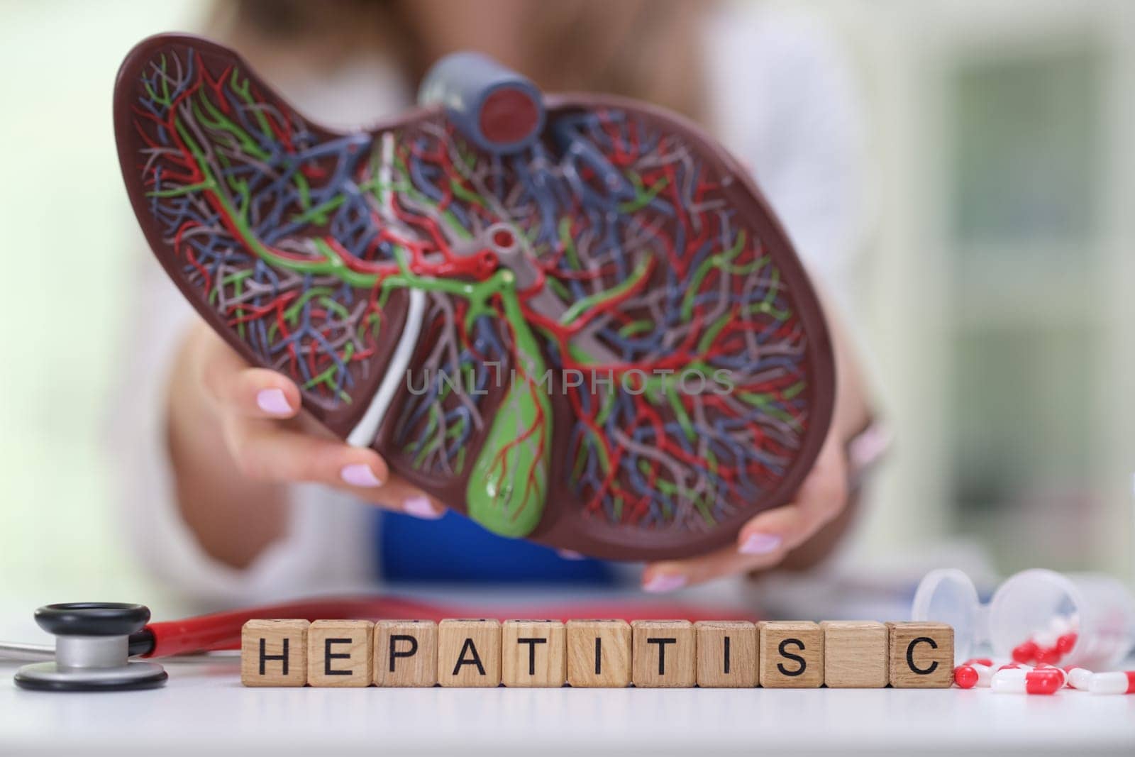 A comprehensive and detailed liver model that illustrates hepatitis C, crucial for enhancing healthcare education