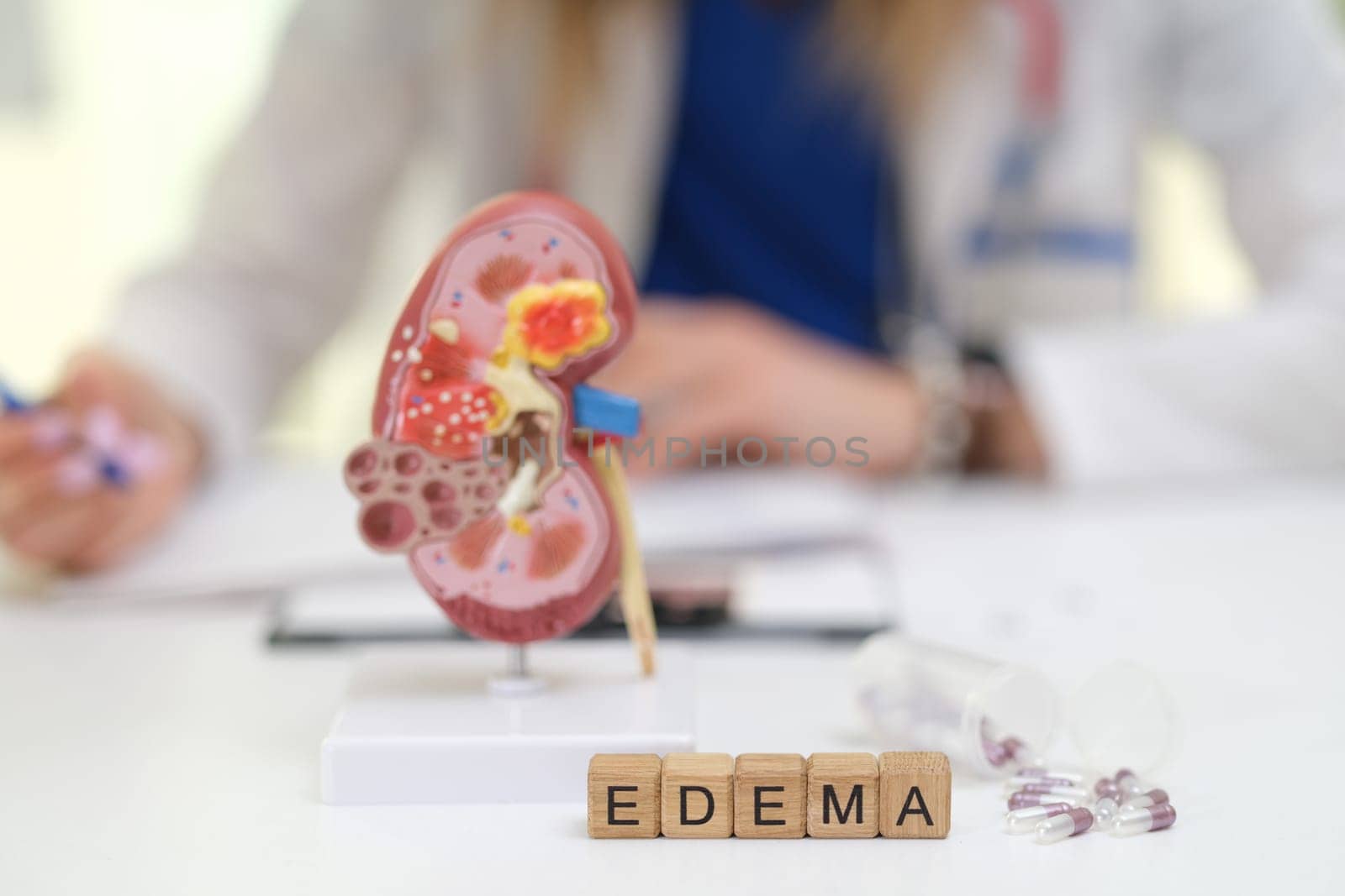 A detailed kidney model highlighting edema aspects, vital for medical education and public awareness