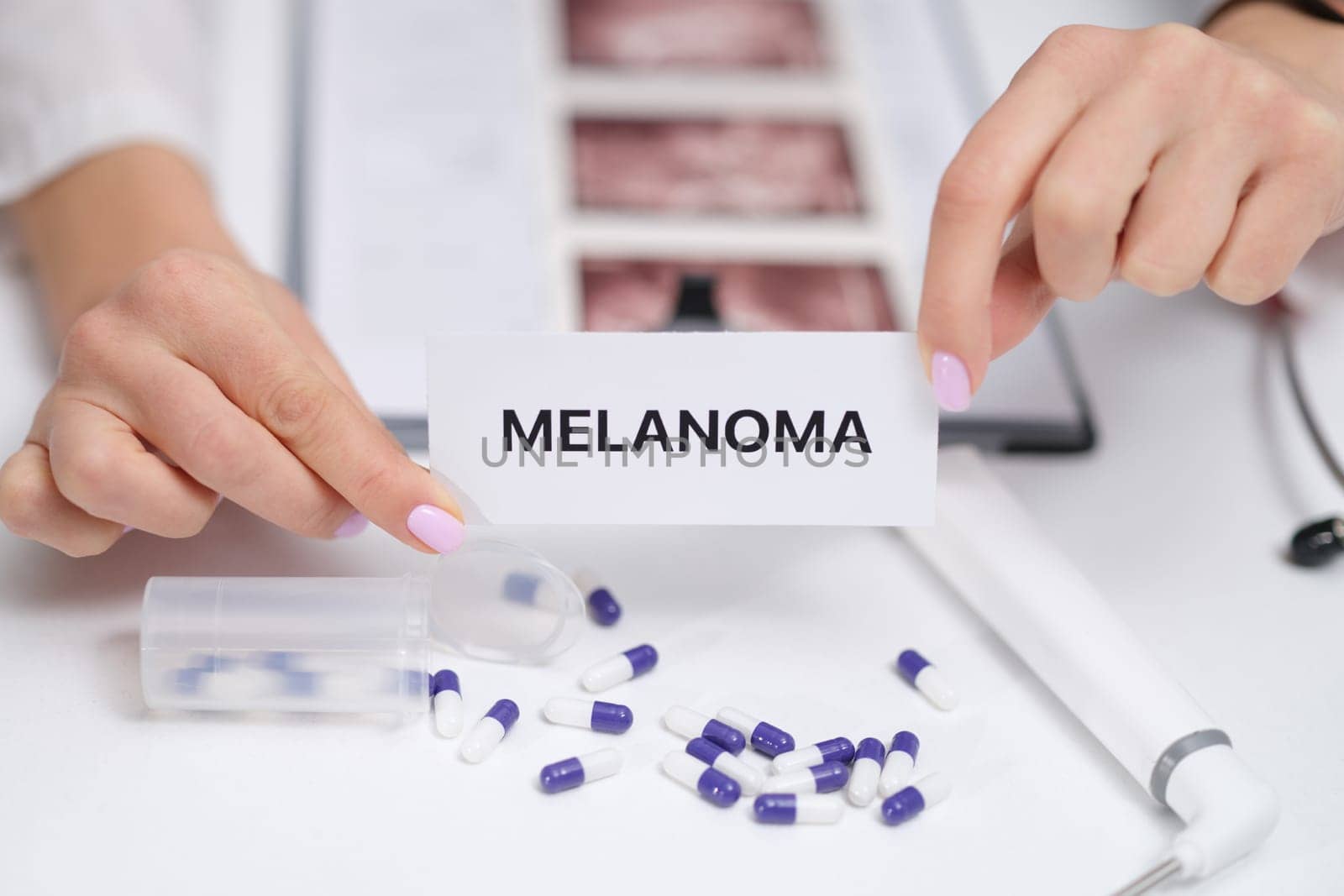Delve into essential insights regarding melanoma, its detection methods, treatment options, and prevention strategies