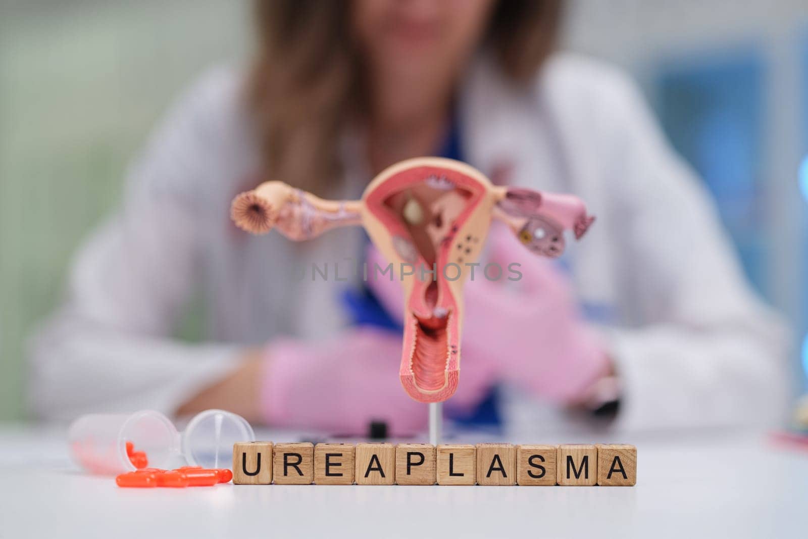 Delve into the impact of Ureaplasma on reproductive health through this comprehensive and detailed medical illustration