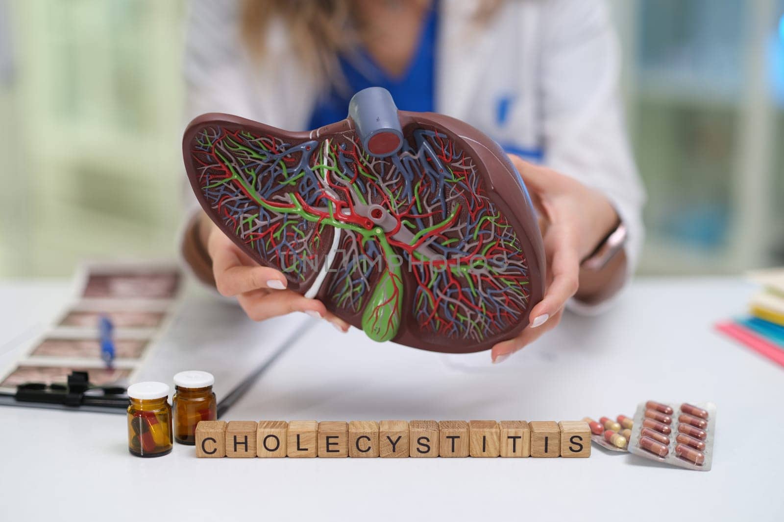 This anatomical model clearly illustrates the gallbladder along with its connections, emphasizing cholecystitis