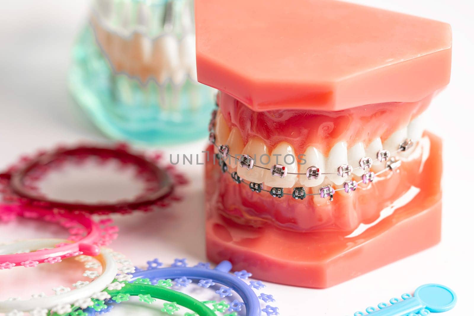 Orthodontic ligatures rings and ties, elastic rubber bands on orthodontic braces, model for dentist studying about dentistry.