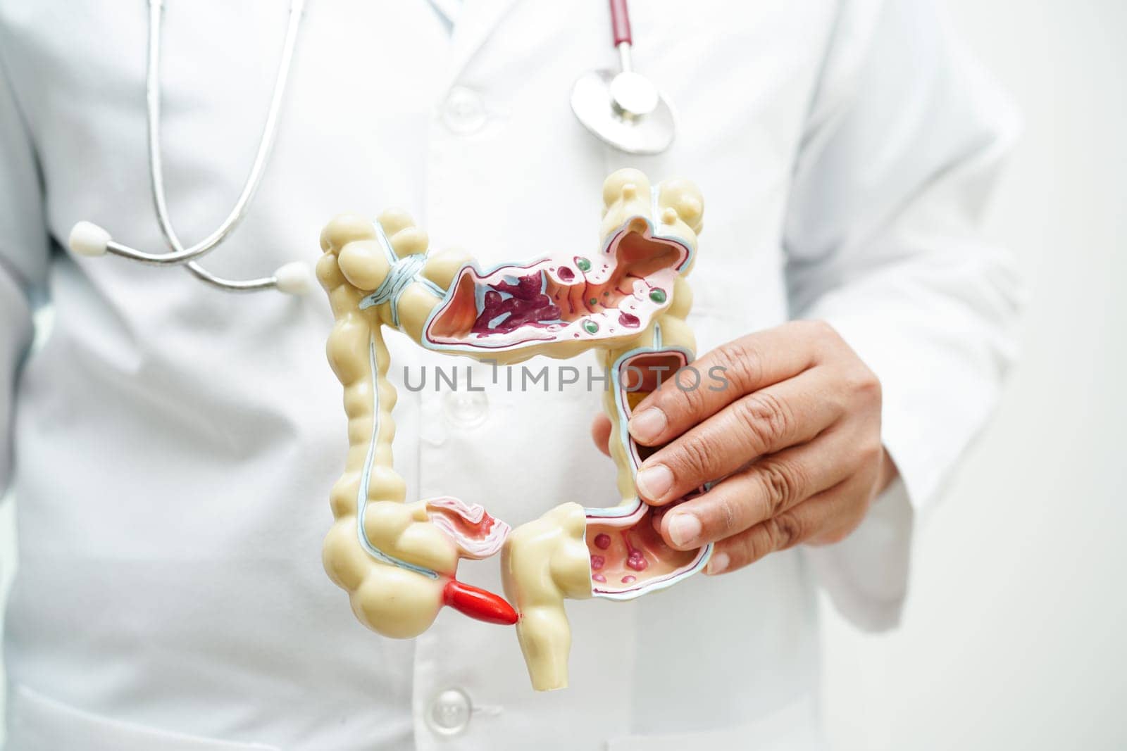 Intestine, doctor holding anatomy model for study diagnosis and treatment in hospital.