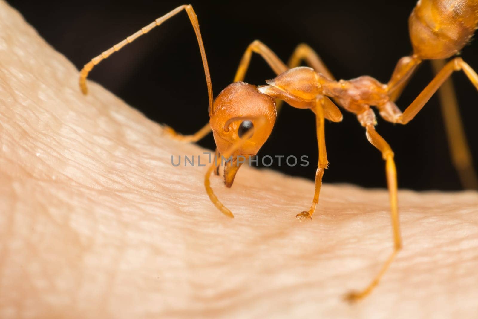 Macro of ant (Red Ant or Green Tree Ant) biting on the human skin for self-defense or self-protection from human