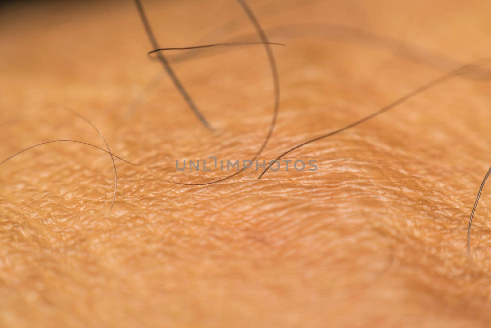 Macro of dry skin asian human with black hairy and pores on wrinkles skin