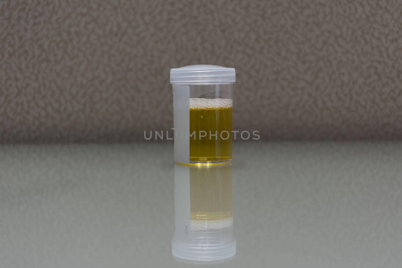Urine sample testing in plastic bottle for examination in laboratory hospital