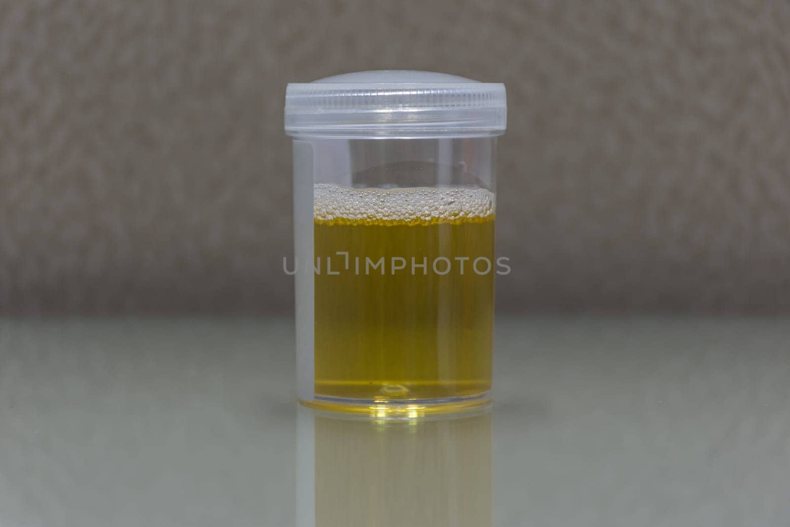 Urine sample testing in plastic bottle for examination in laboratory hospital