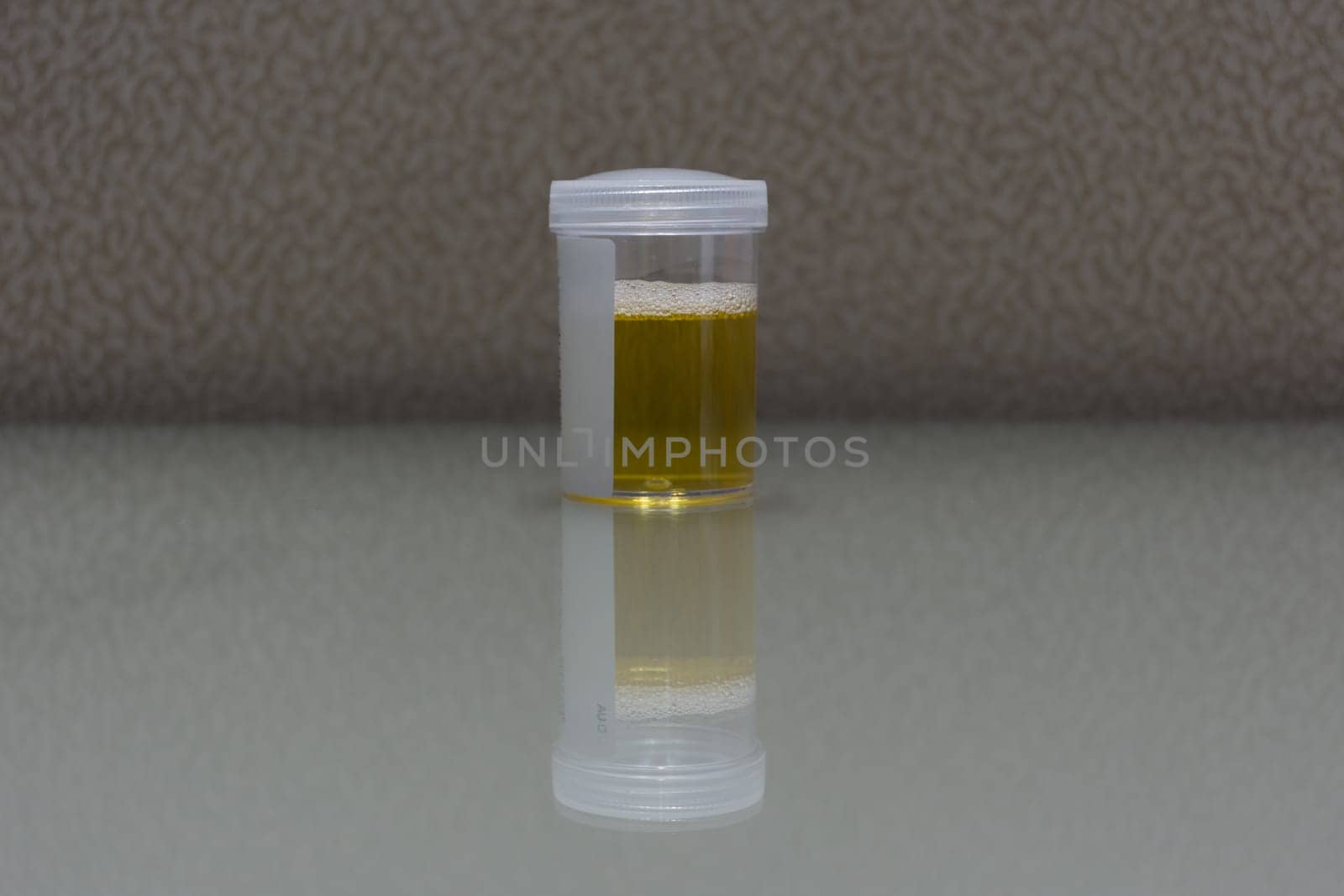 Urine sample testing in plastic bottle for examination in laboratory hospital