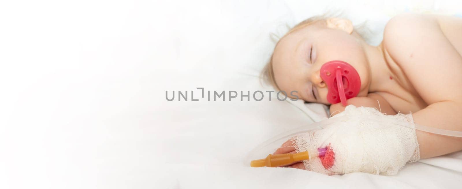 Babygirl sick and sleeping on patient bed at the hospital. Saline intravenous or (IV)drip in baby patient hand. Poor baby looks tired and exhausted.IV fluid replacement or correcting the dehydration. High quality photo