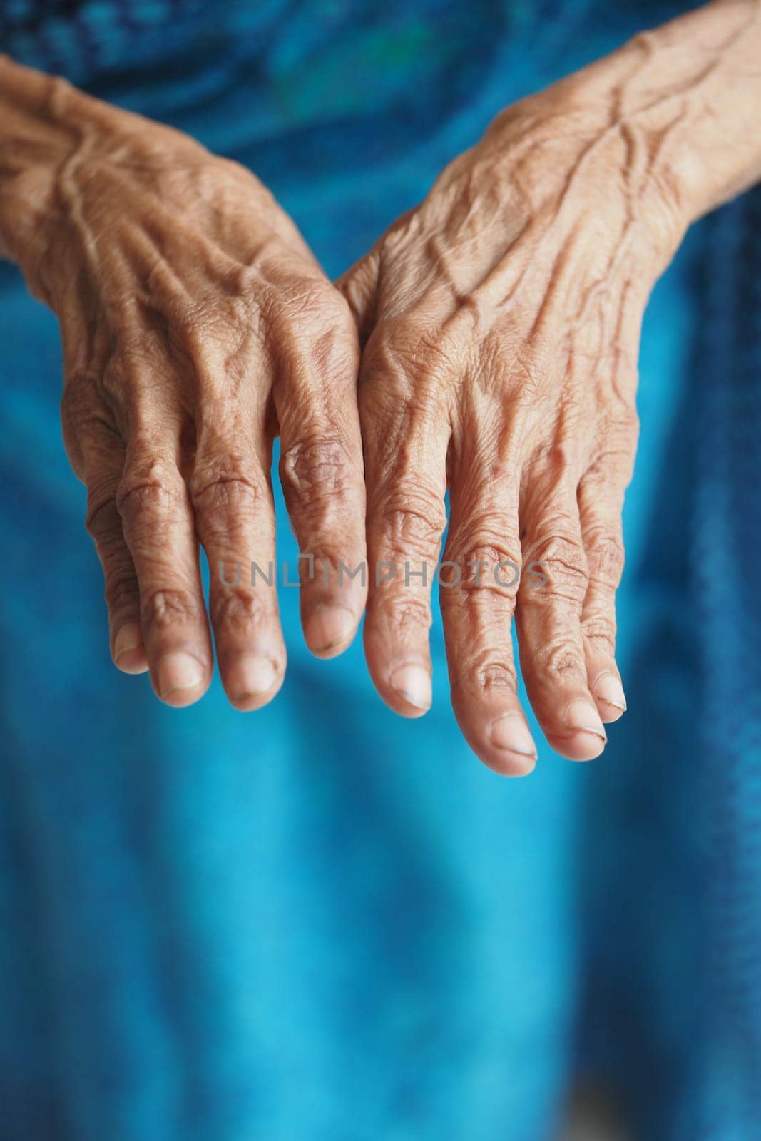Weathered hands demonstrate years of labor and rich life history.