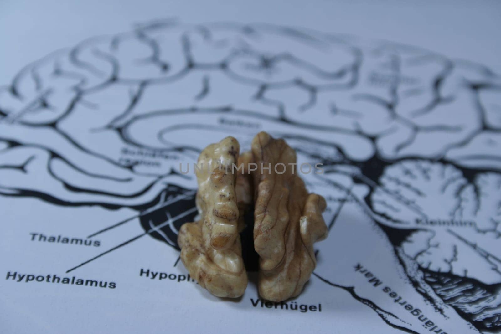 Brain metaphor