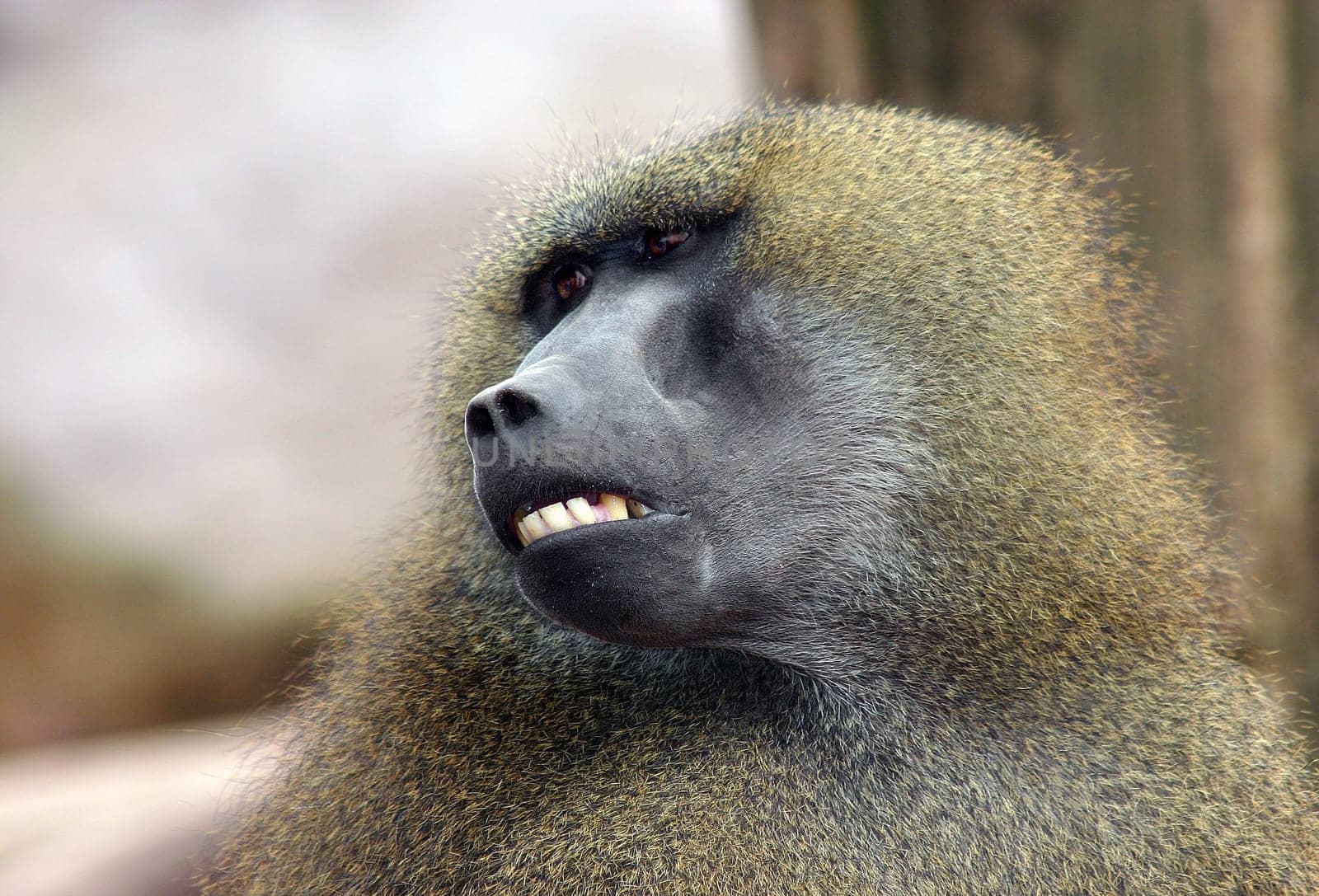 Who stole my maxillary prosthesis?