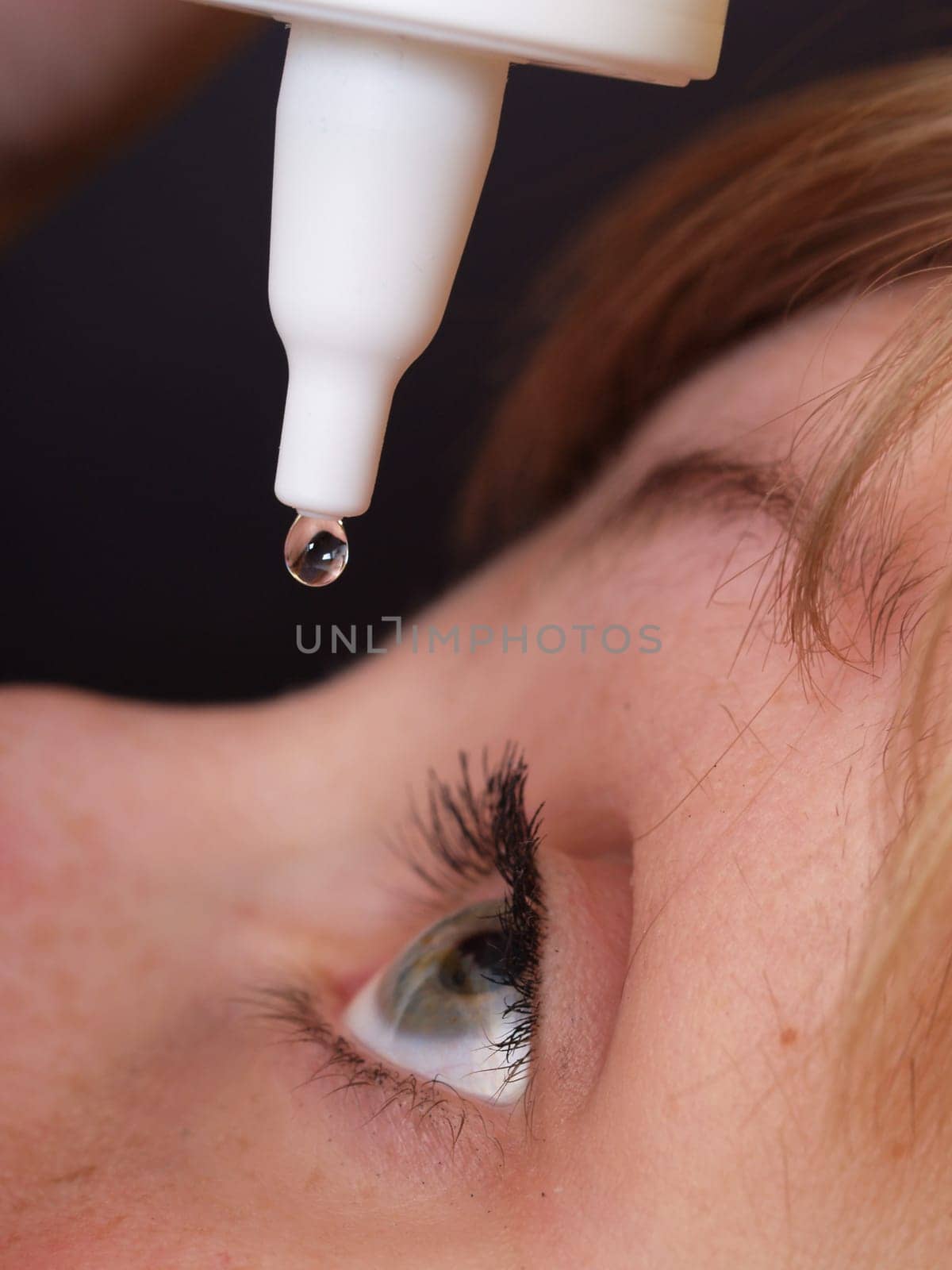Eye drops