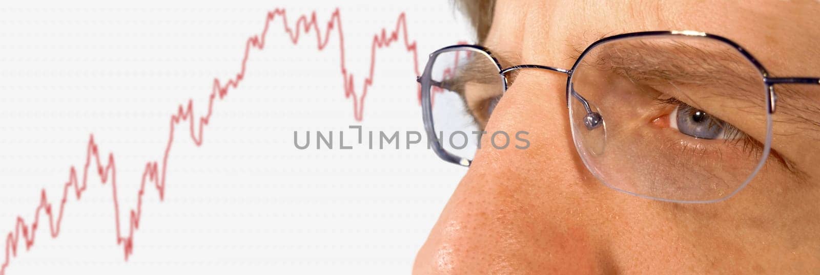 Keeping an eye on development
