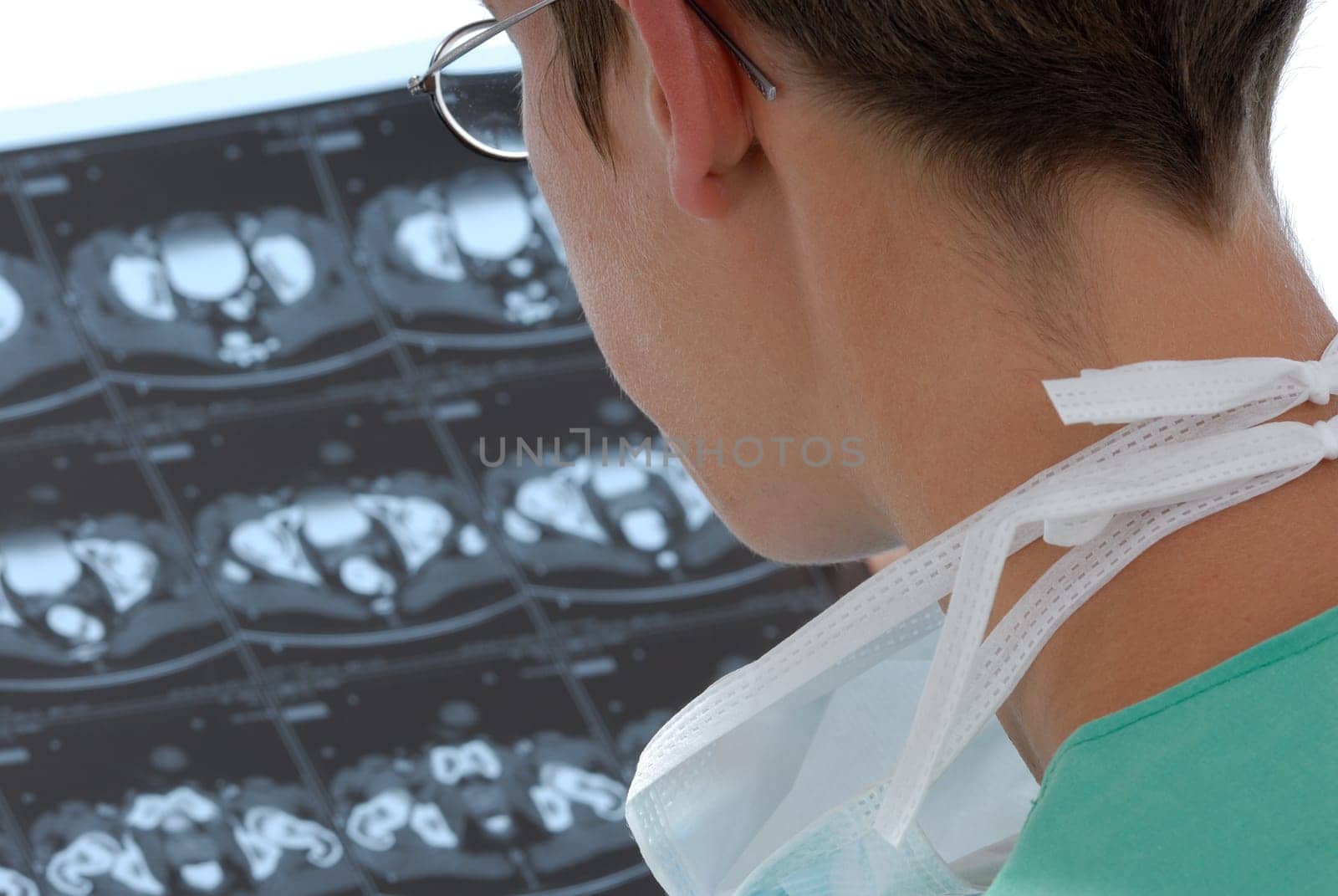physicians analyzing a radiograph
