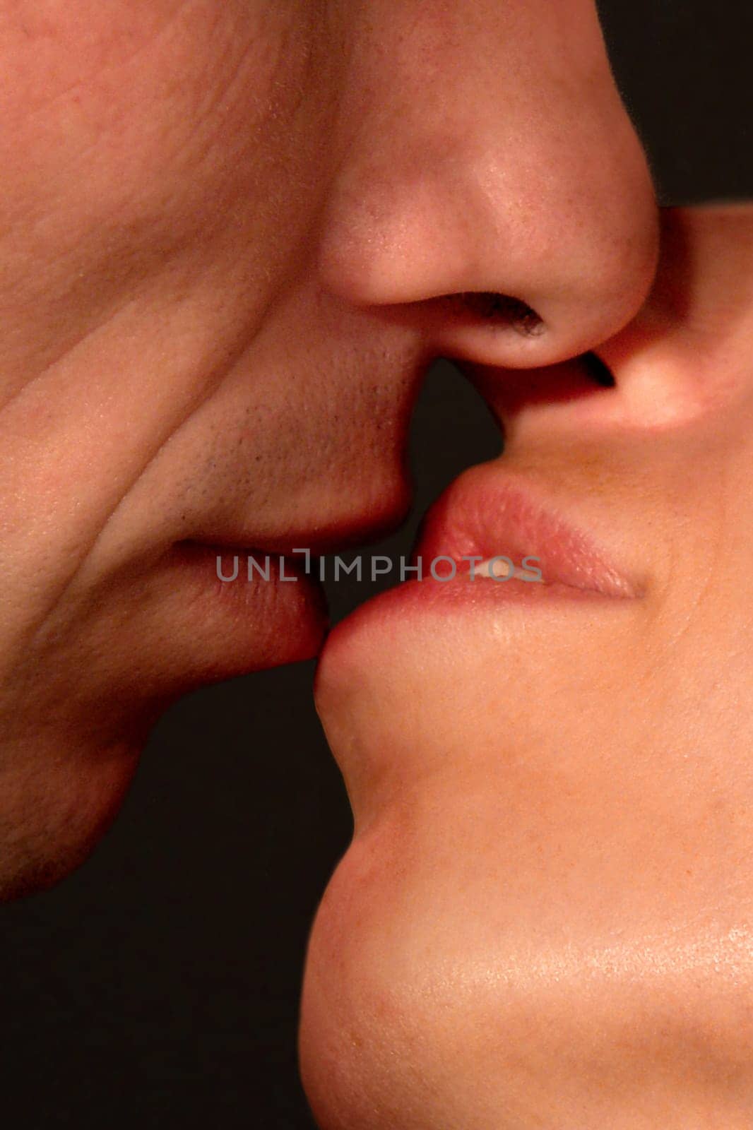 Kiss