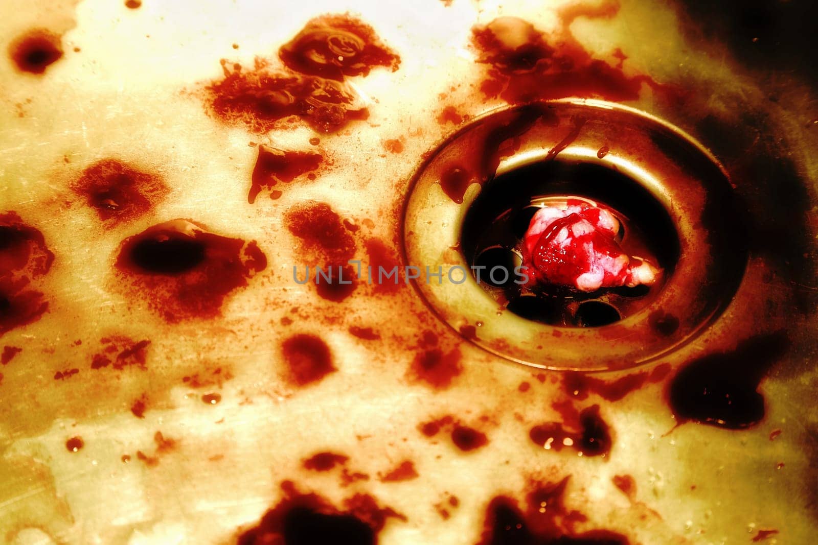 Autopsy