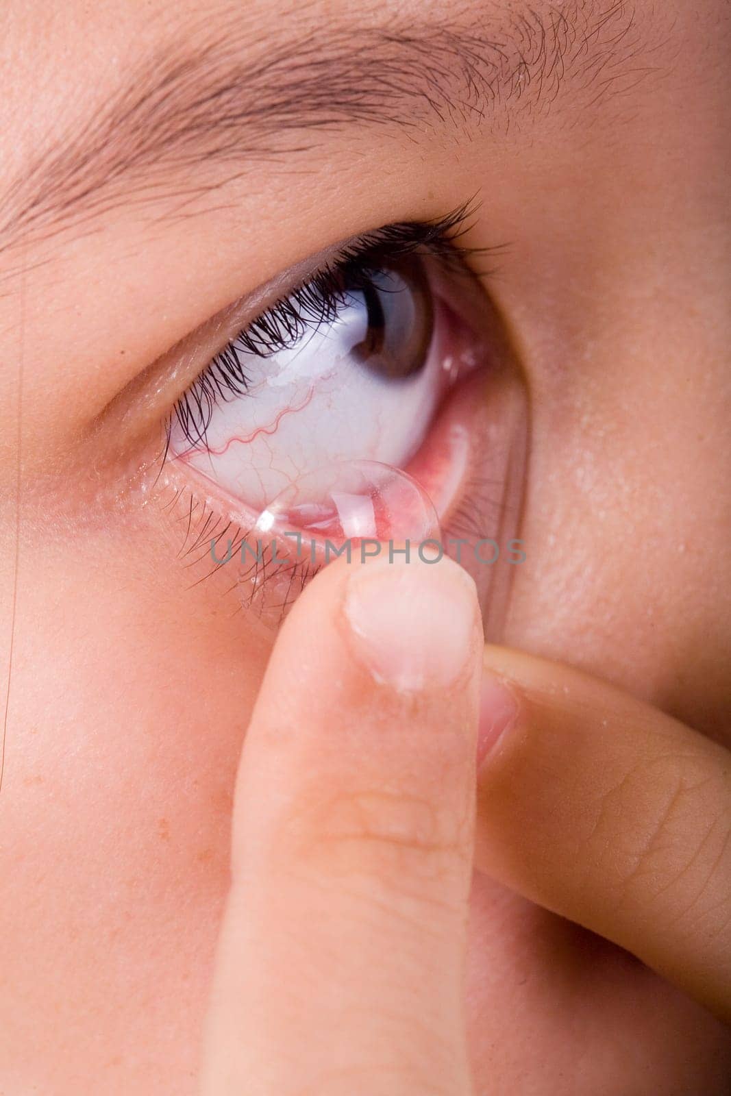 Contact lens