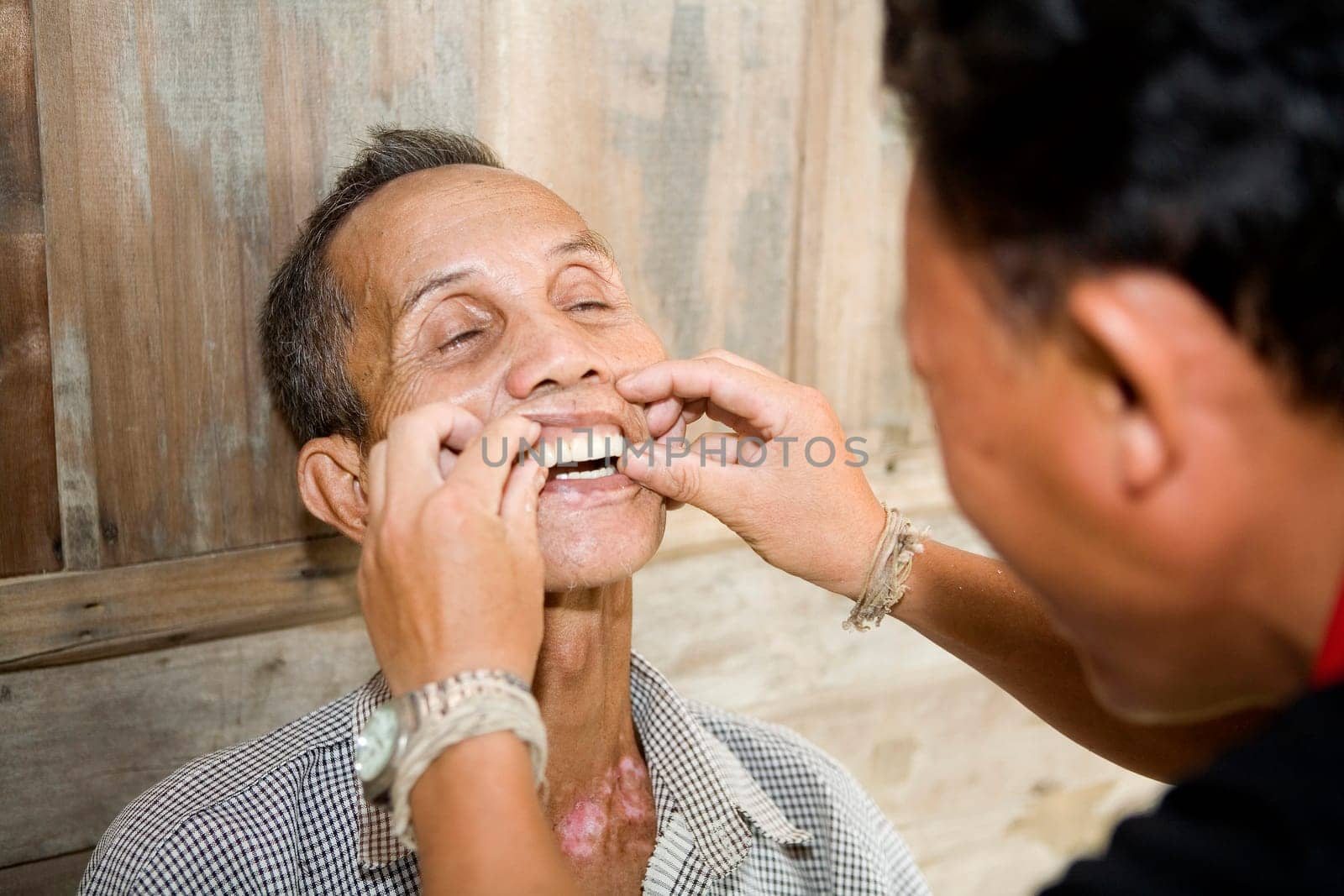 Fitting dentures