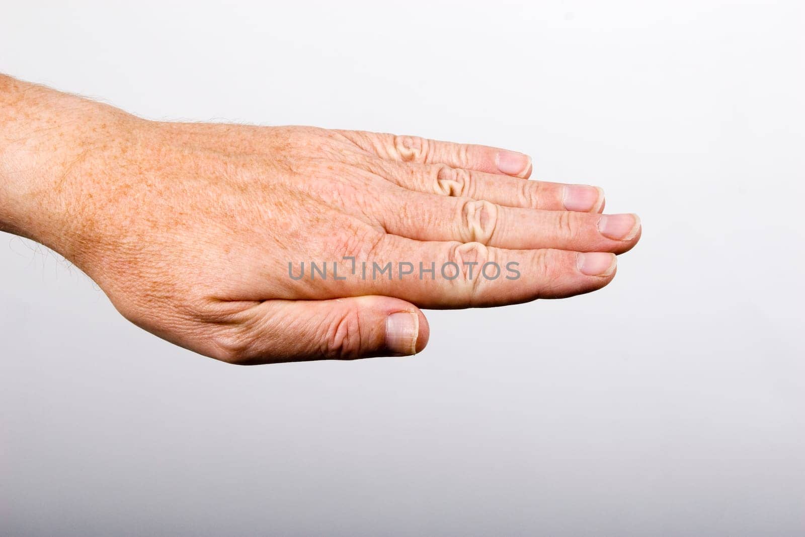 Closed hand