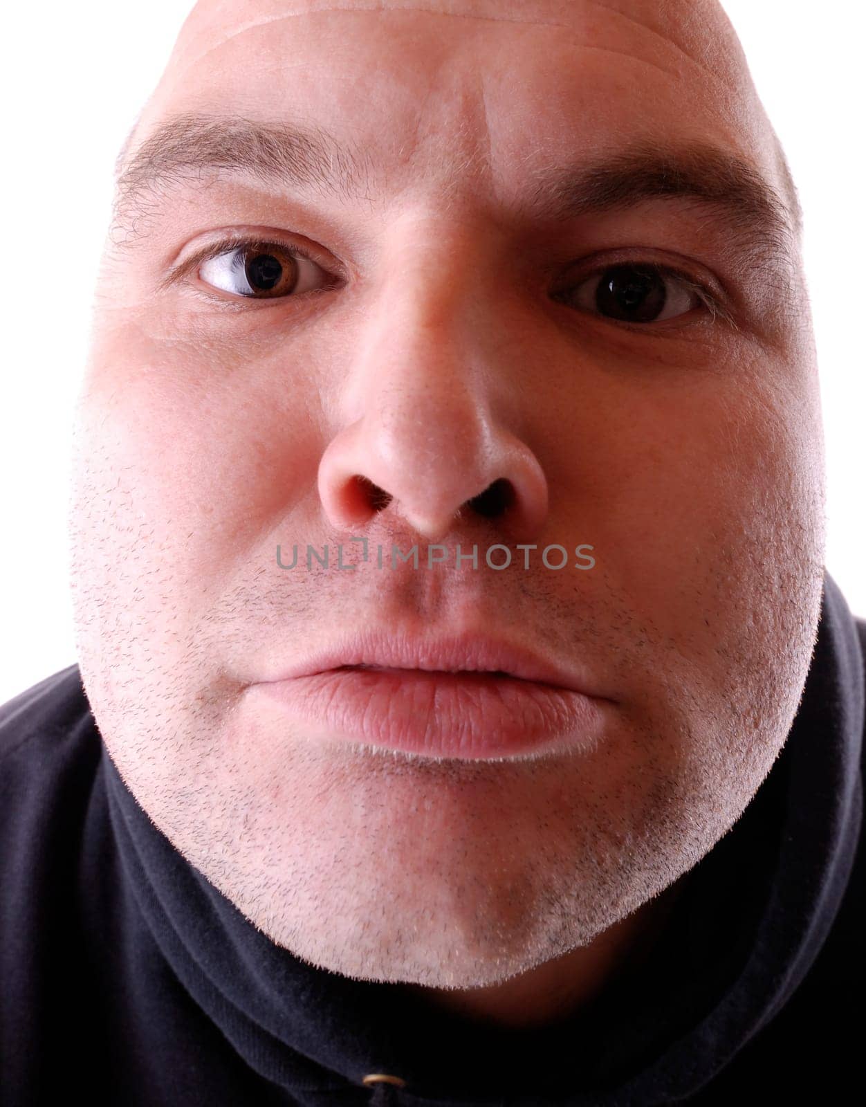Moon face