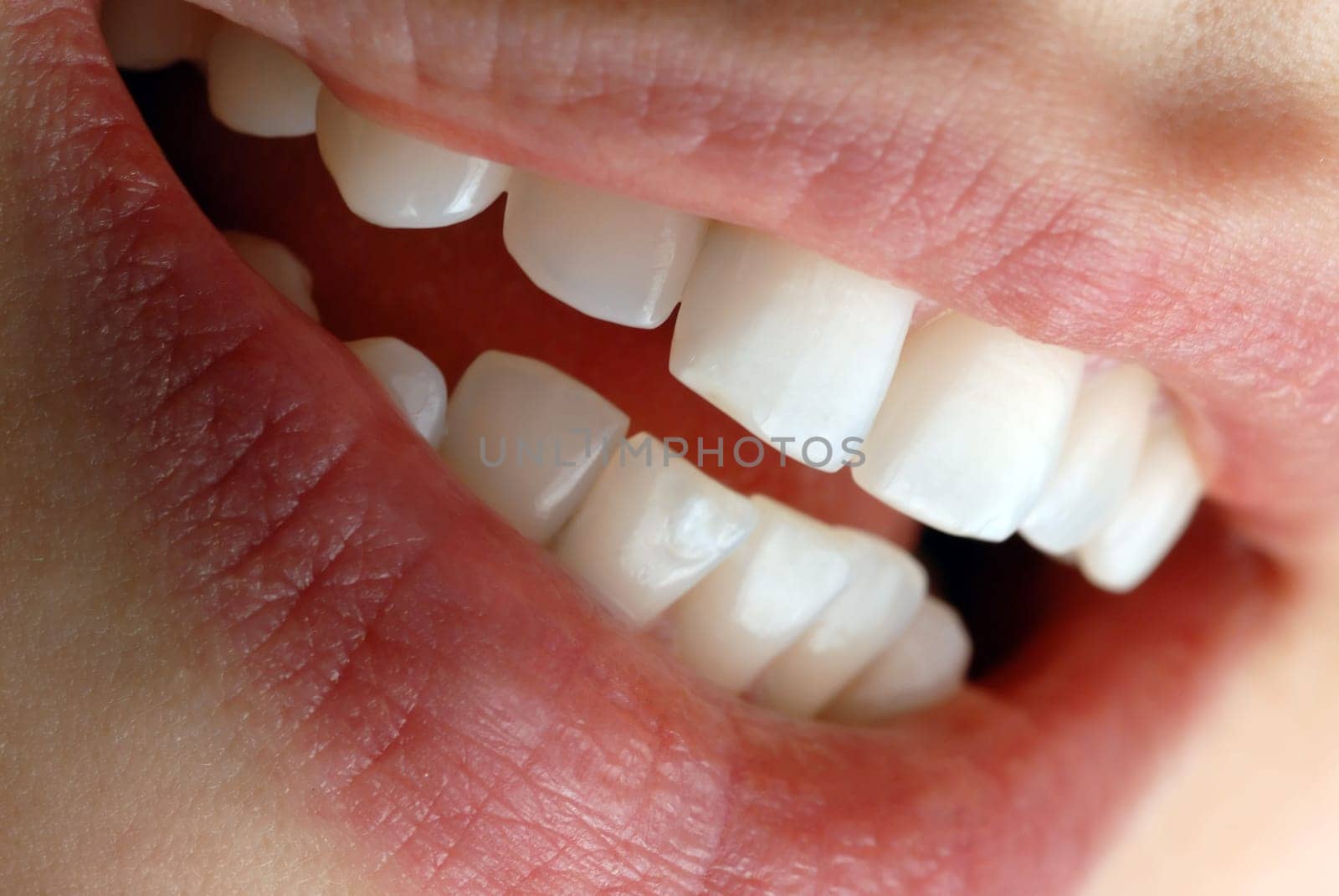 Laughing woman's mouth