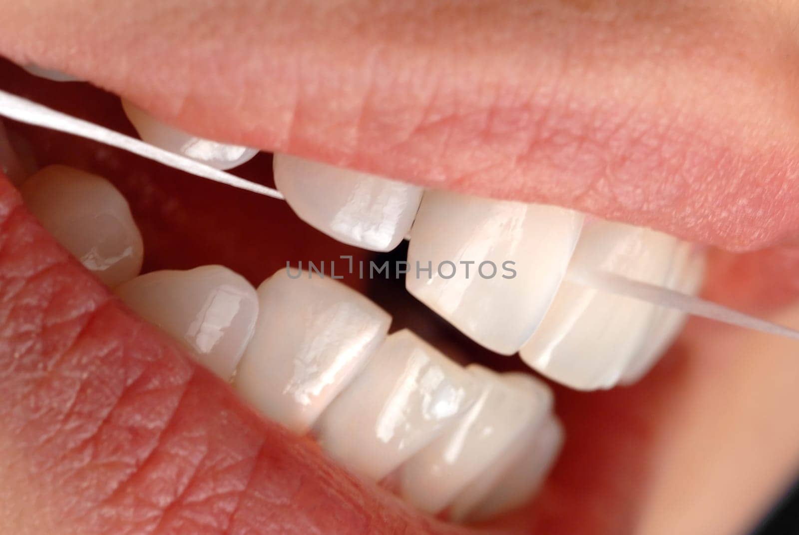 Dental floss