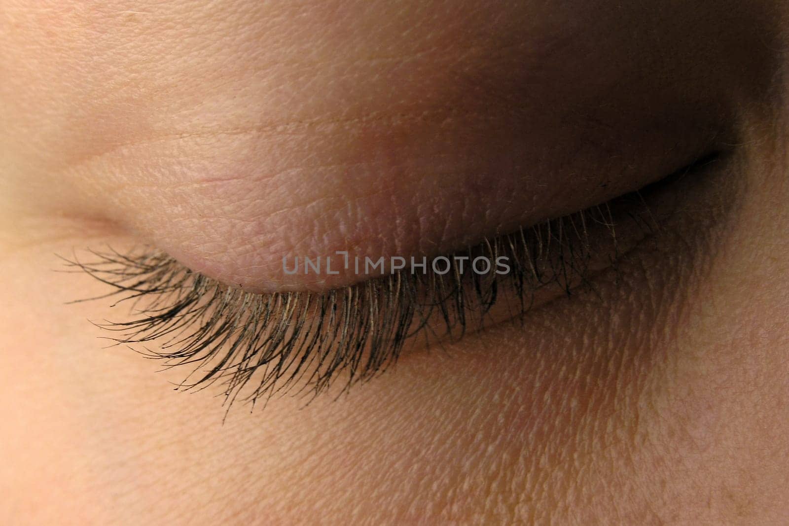 Closed eye
