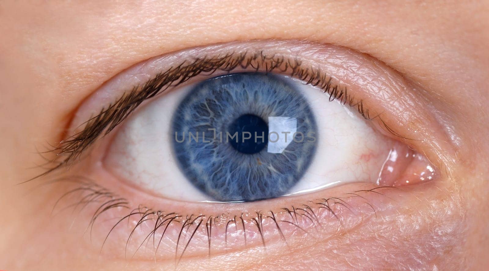 The Eye