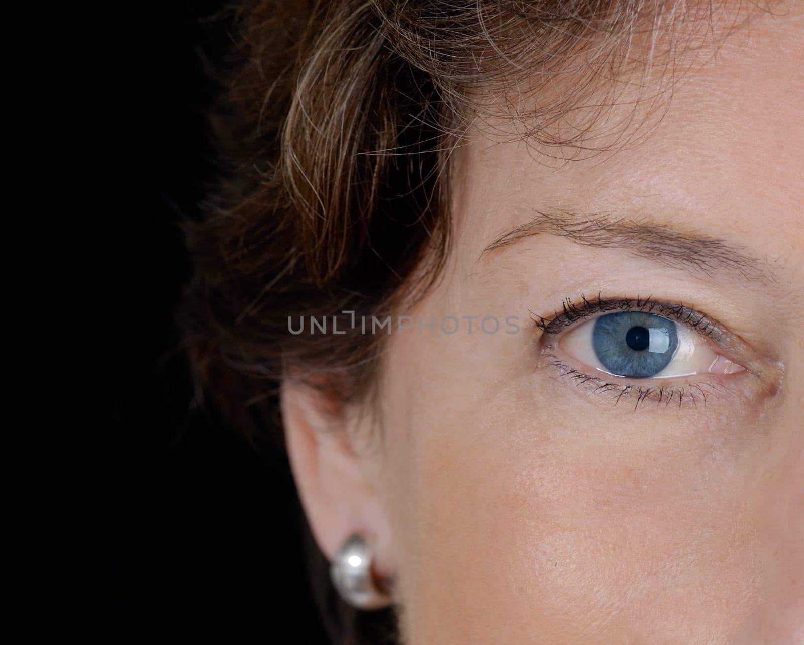 Eye