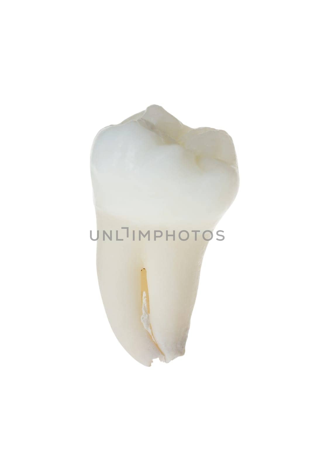 Human tooth