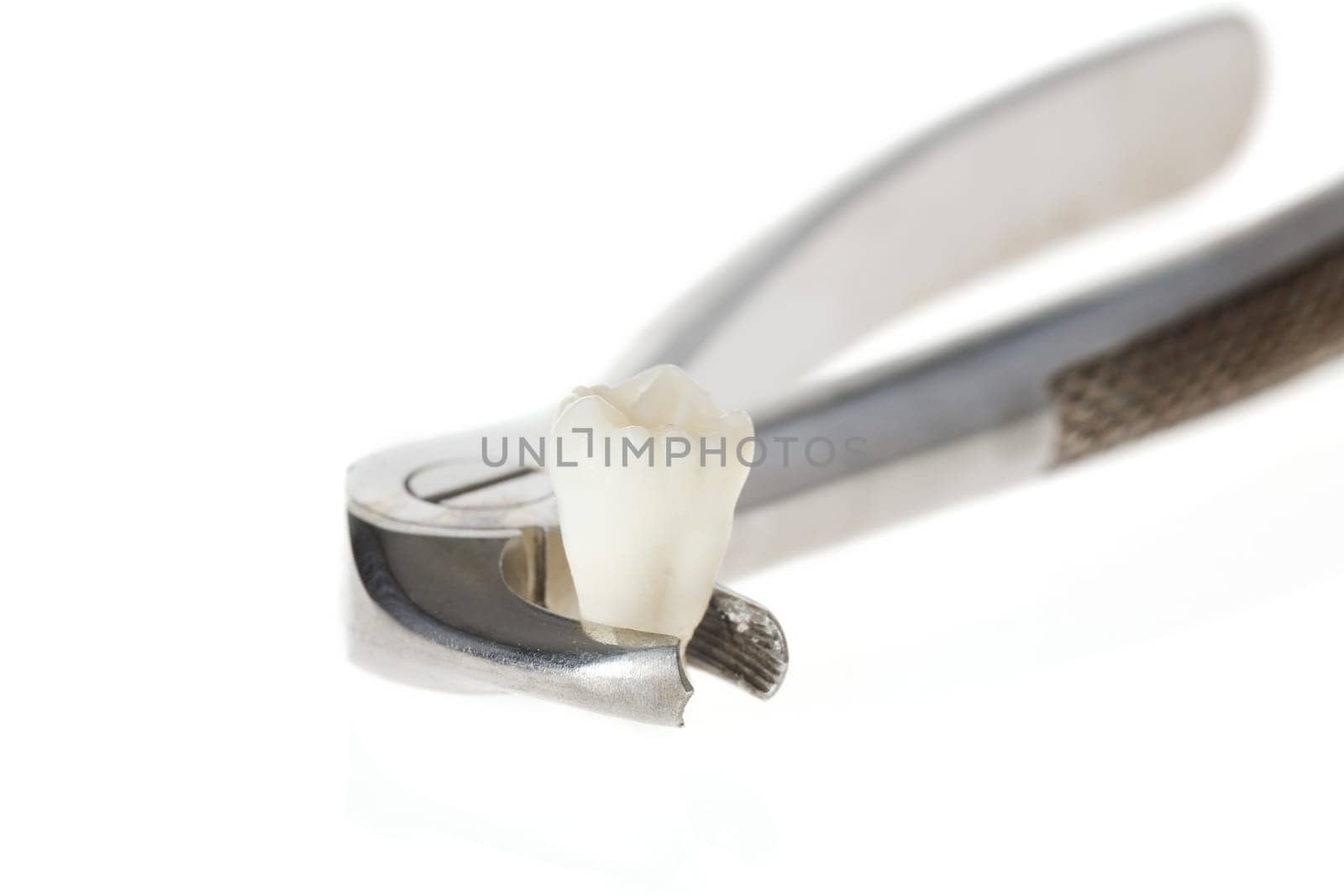 Tooth in forceps