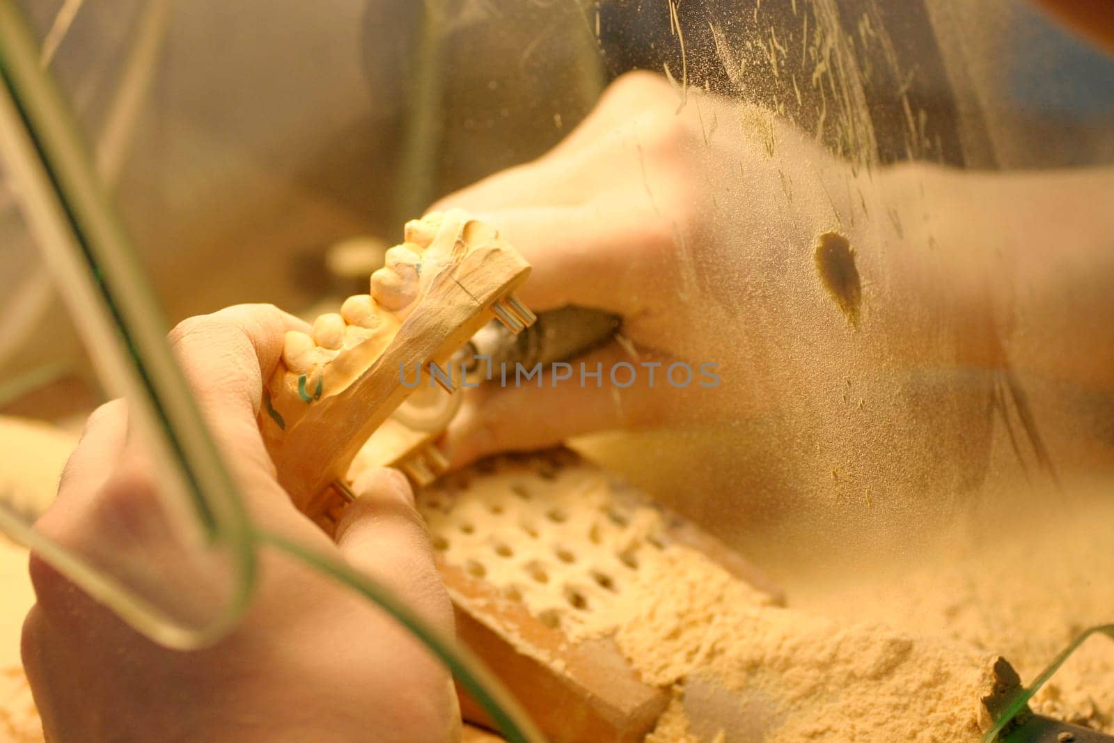 Dental technology,plaster model
