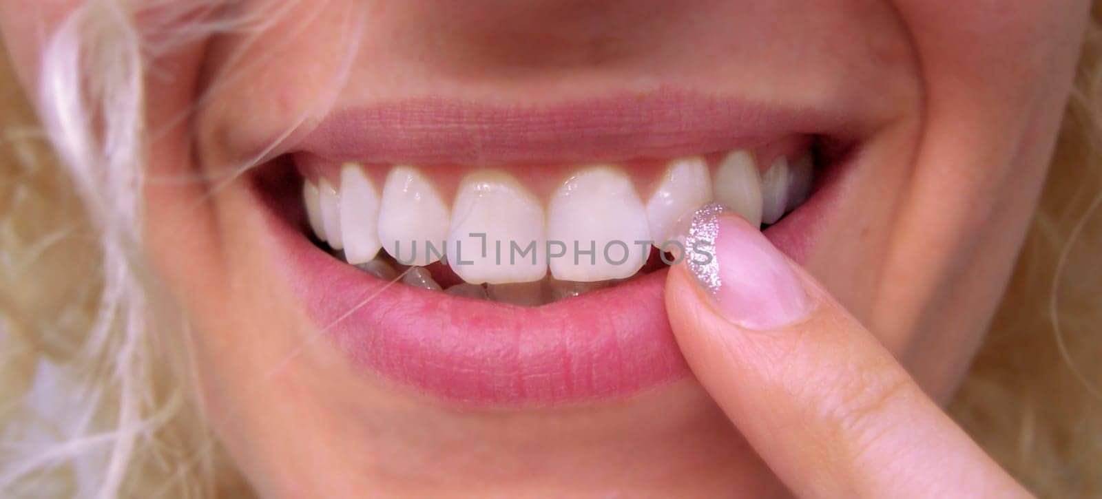 smiles - laugh - Smile - Teeth
