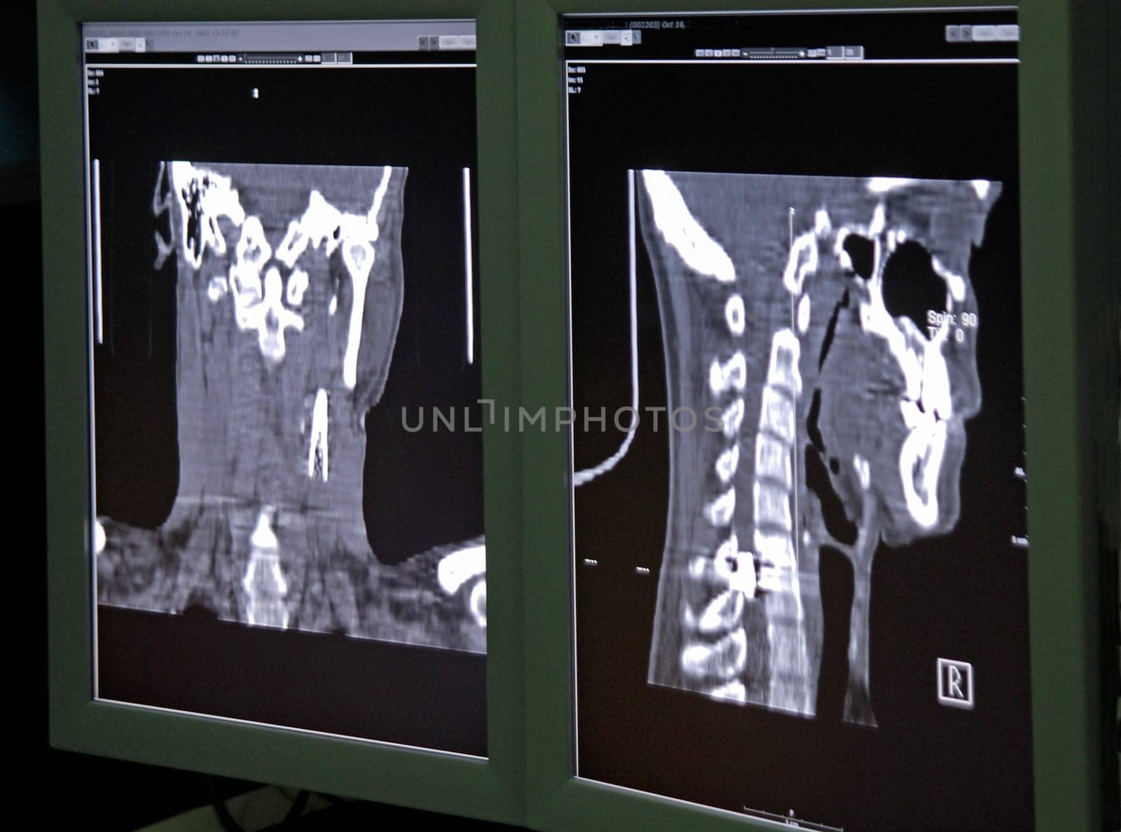 X-ray image shot: