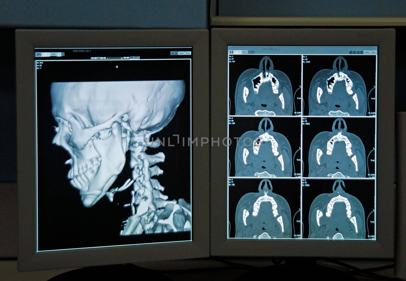Radiograph