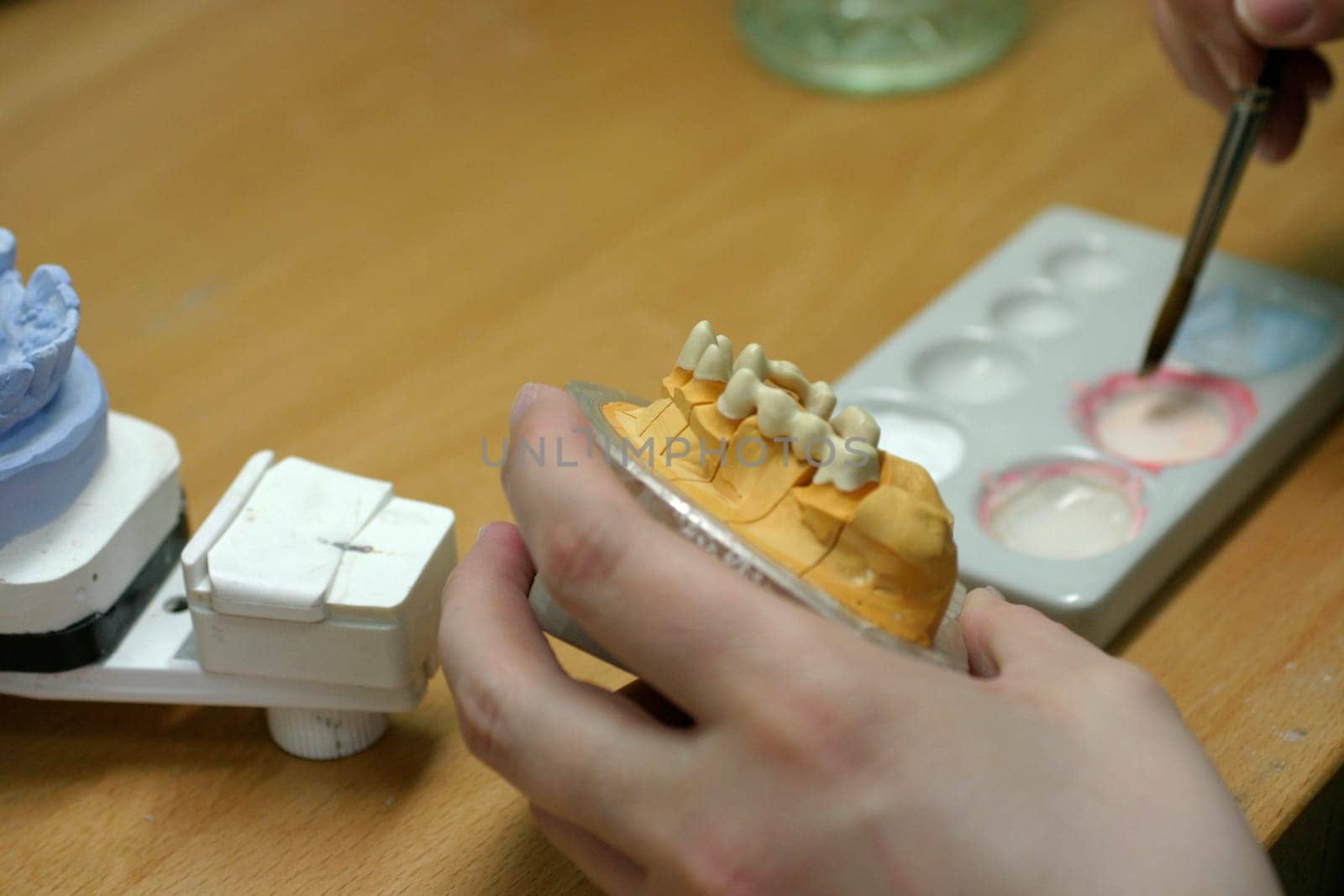 Tooth model of a jaw