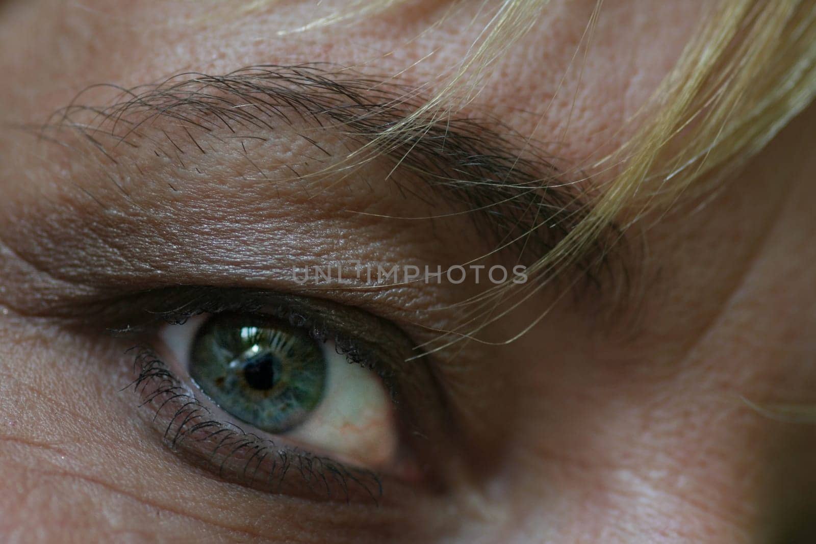 Eye
