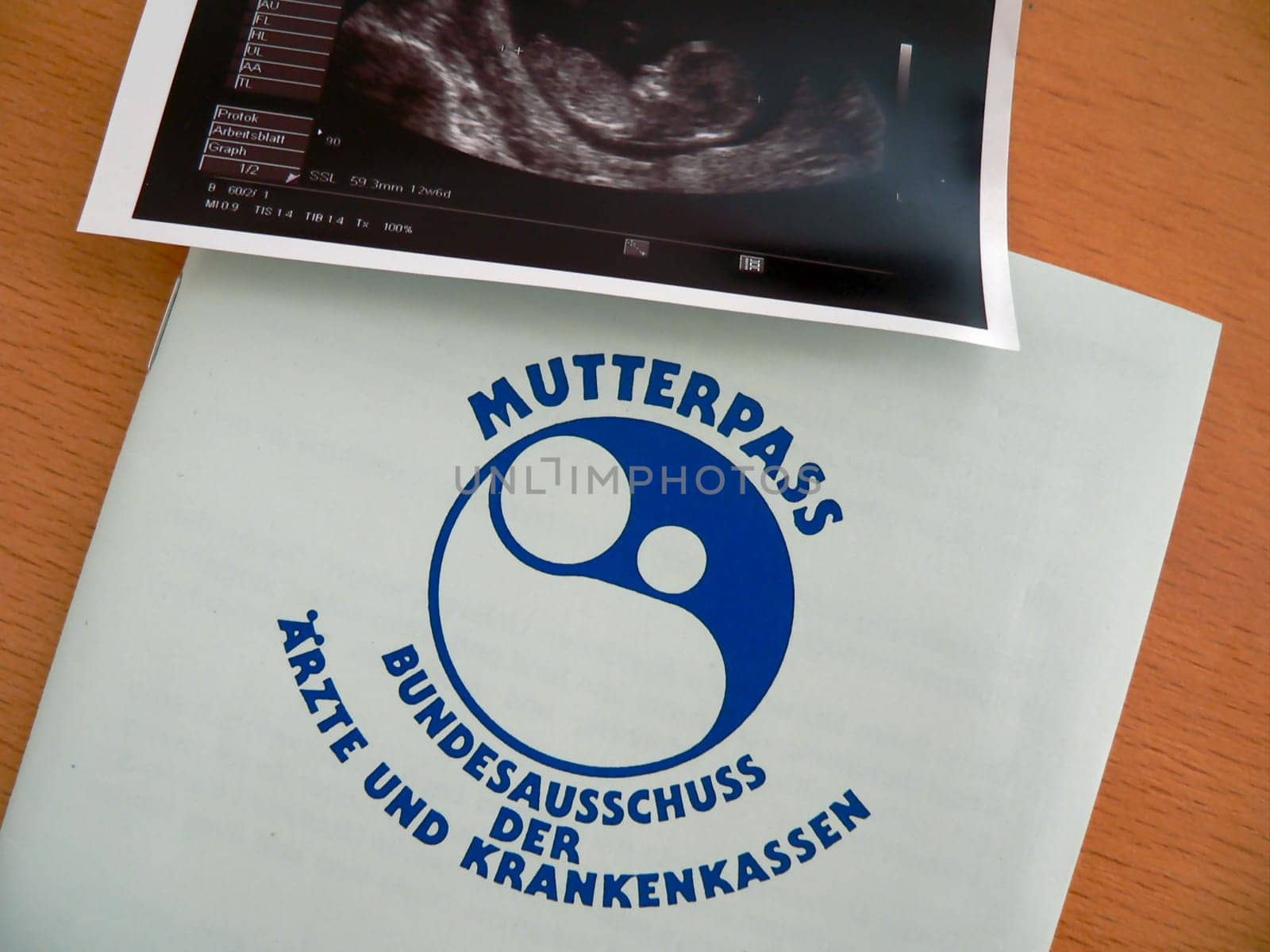 Ultrasound image
