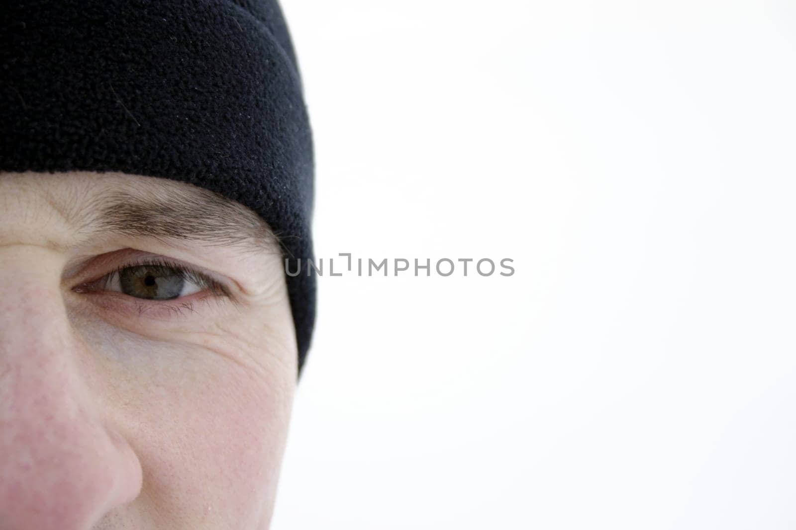 Eye