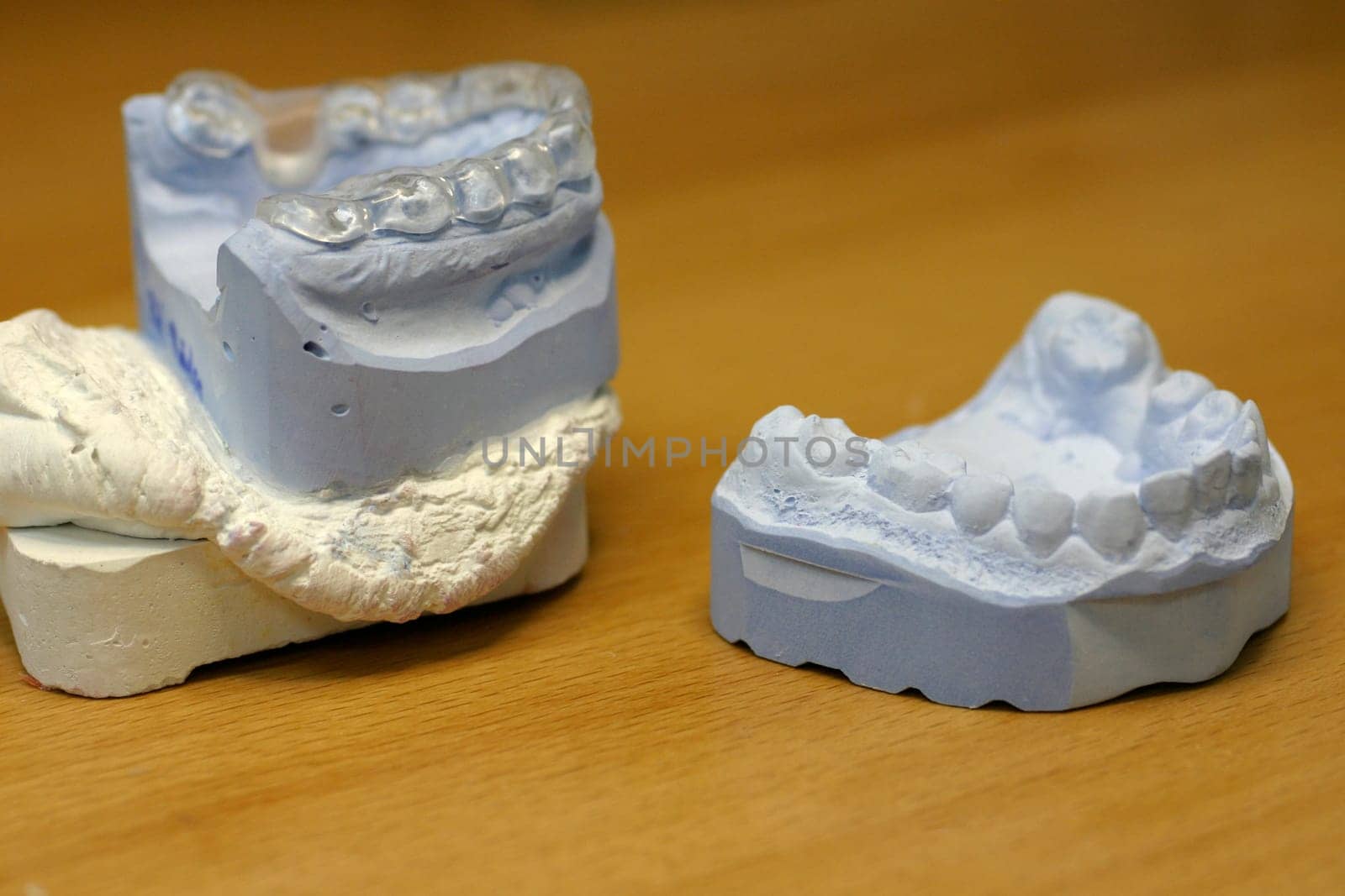 Dentures