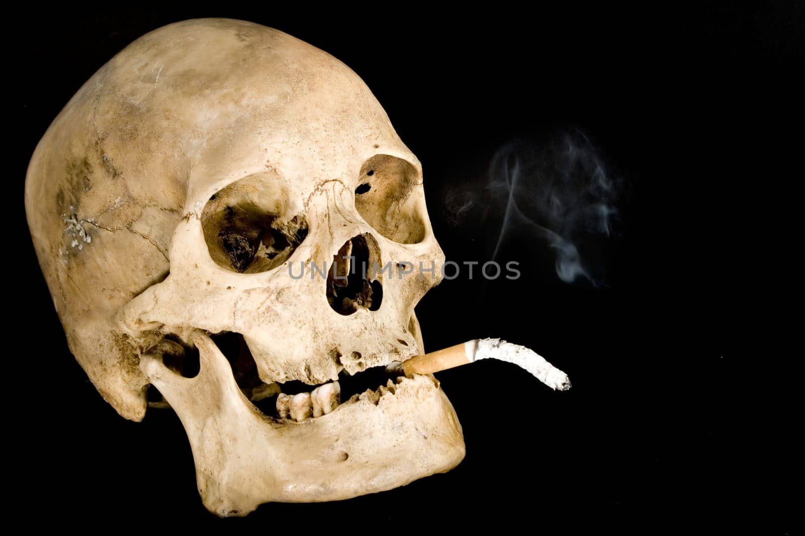 Nicotine addiction
