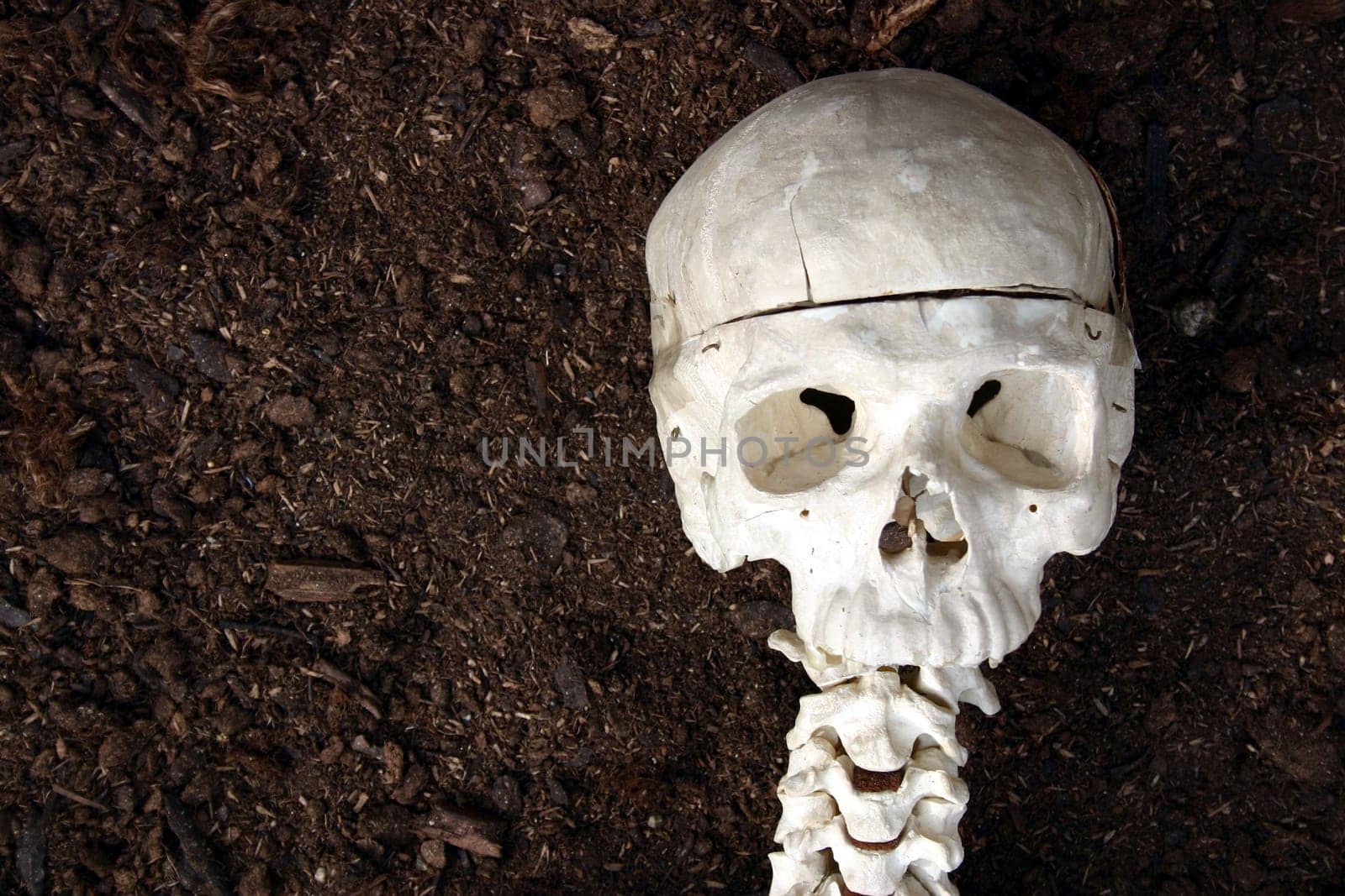 Skull