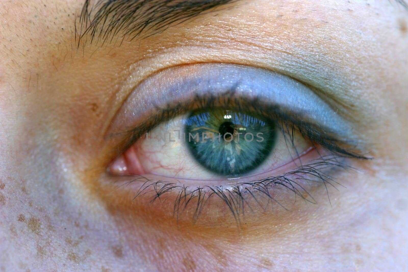 Close-up of a black eye