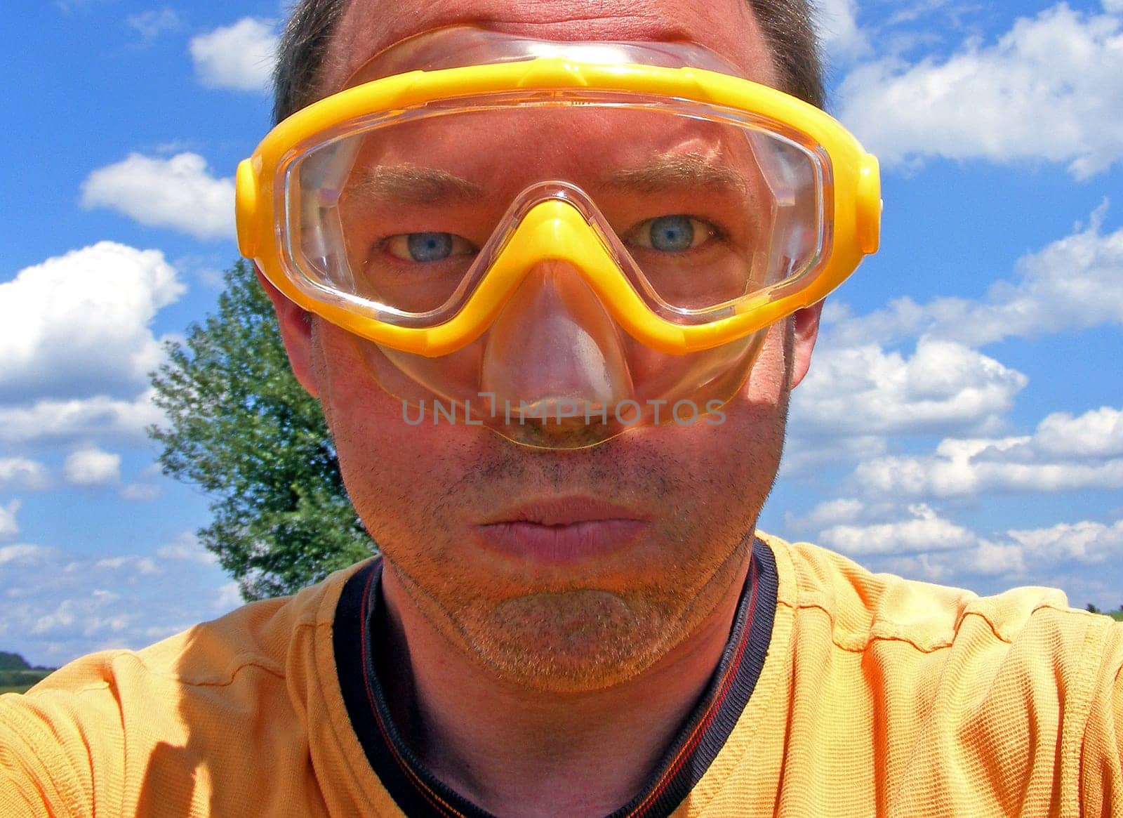 ... and then sunburn -) [Selfshot]