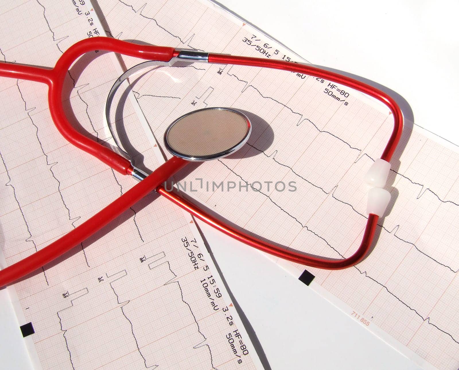 ELECTROCARDIOGRAM